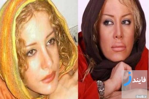 قبل و بعد از عمل جراحی بینی بازیگران زن سینمای ایران