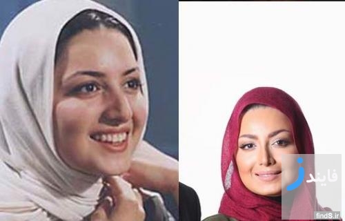 قبل و بعد از عمل جراحی بینی بازیگران زن سینمای ایران