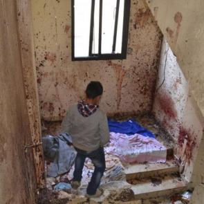 پسری در حال پایین رفتن از پله یک ساختمان در شمال طرابلس لبنان پس یک درگیری
عکس منتخب هفته خبرگزاری رویترز