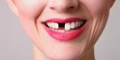 عادت‌هایی که به دندان‌هایتان آسیب جدی وارد می کند