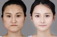 رقابت شدید در بازار کار چین، جوانان را مجبور به انجام جراحی‌های زیبایی می کند