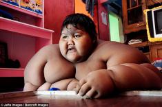 تصاویر چاق‌ترین کودک دنیا بعد از کاهش وزن 106 کیلوگرمی را ببینید!
